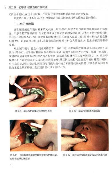 最新义齿技术引领口腔健康新时代